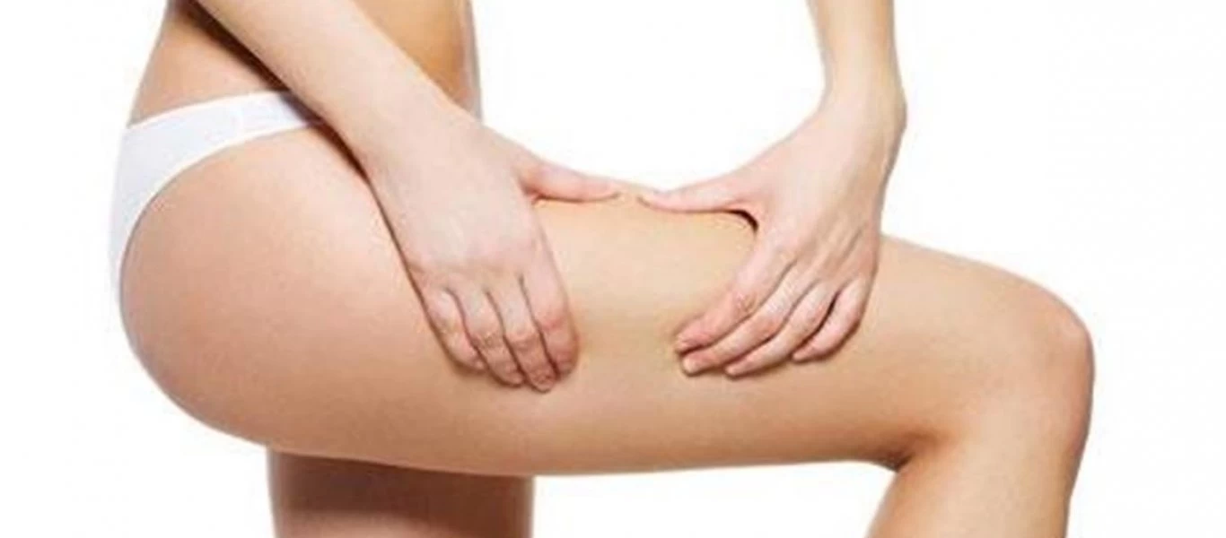 Κυτταρίτιδα ο... «εχθρός» των γυναικών: Δείτε πως θα την αντιμετωπίσετε! (βίντεο)